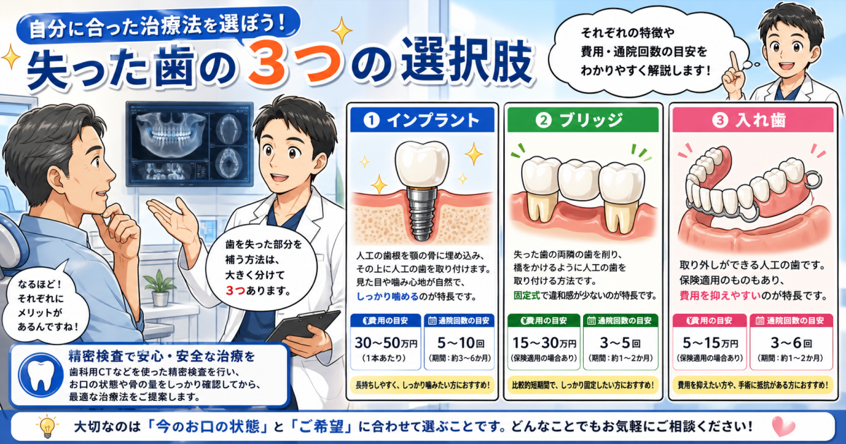 抜歯後どうする？インプラント・ブリッジ・入れ歯の費用と期間を比較