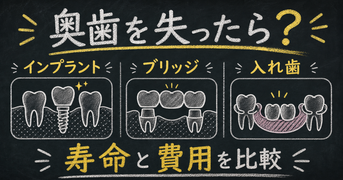 奥歯を失った方へ｜インプラント・ブリッジ・入れ歯の寿命と費用比較
