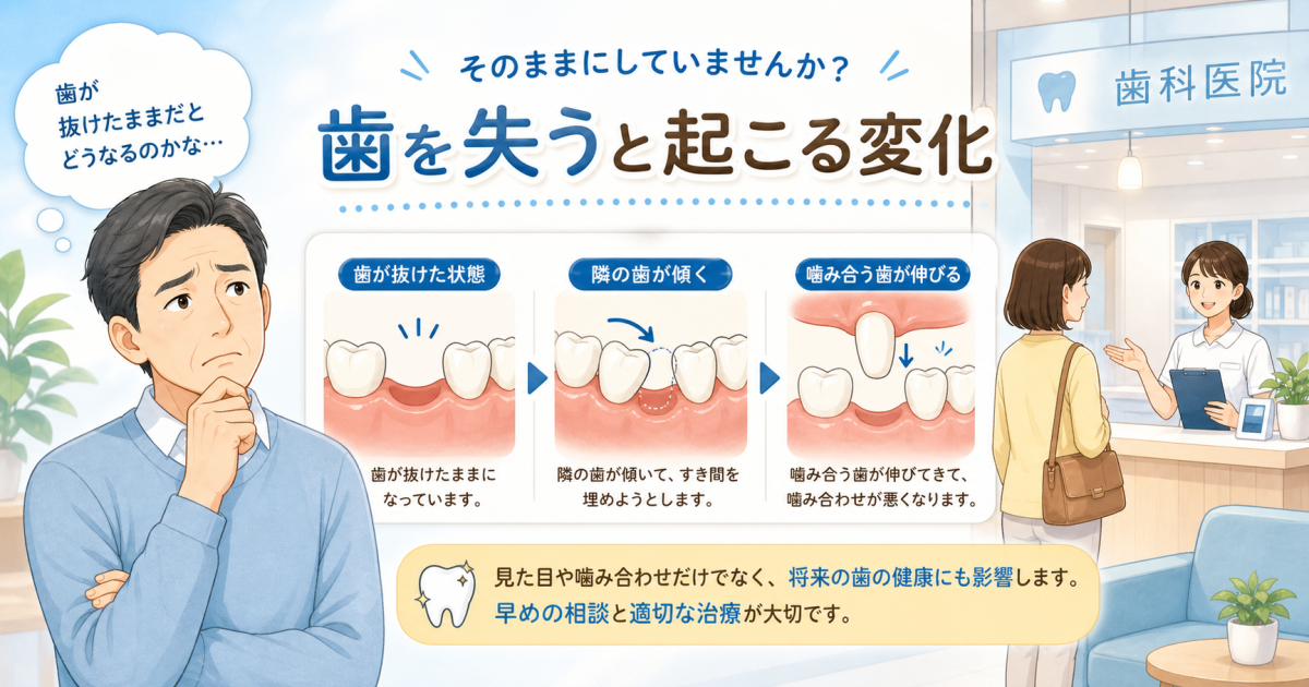 歯を抜けたまま放置する影響は？噛み合わせ崩壊や肩こりを防ぐ3つの治療法