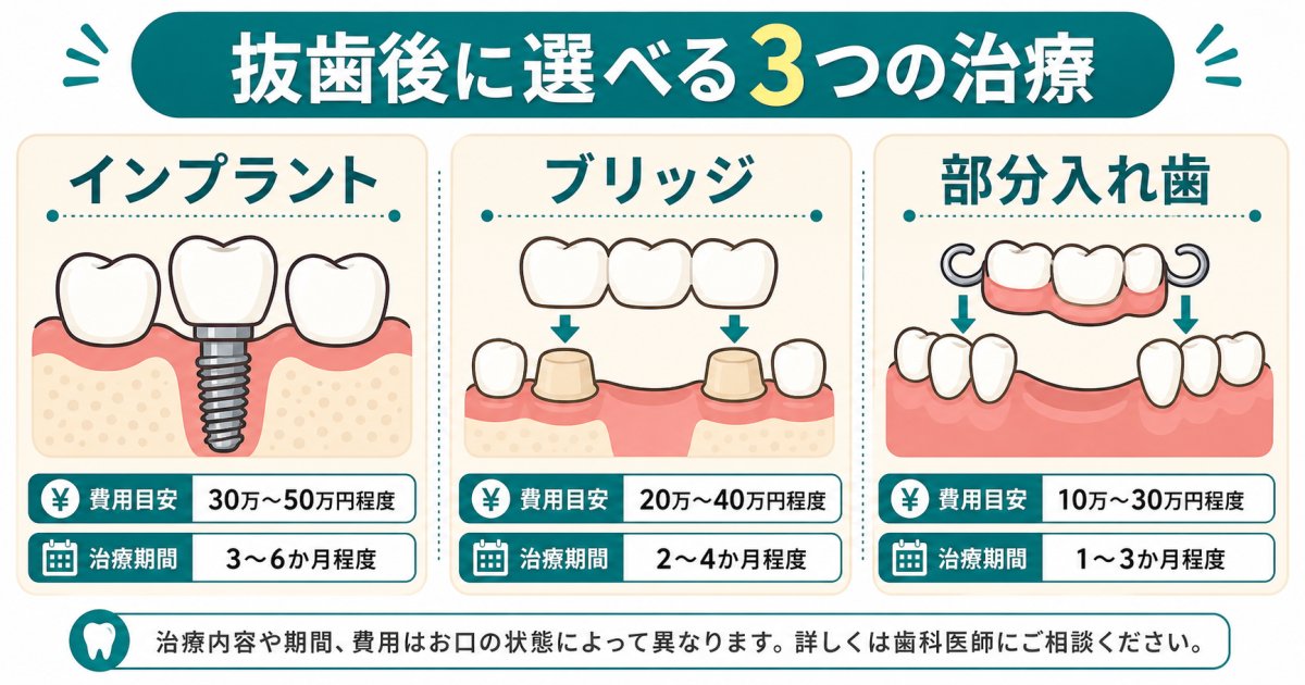 抜歯を避けられない場合の次のステップと治療法