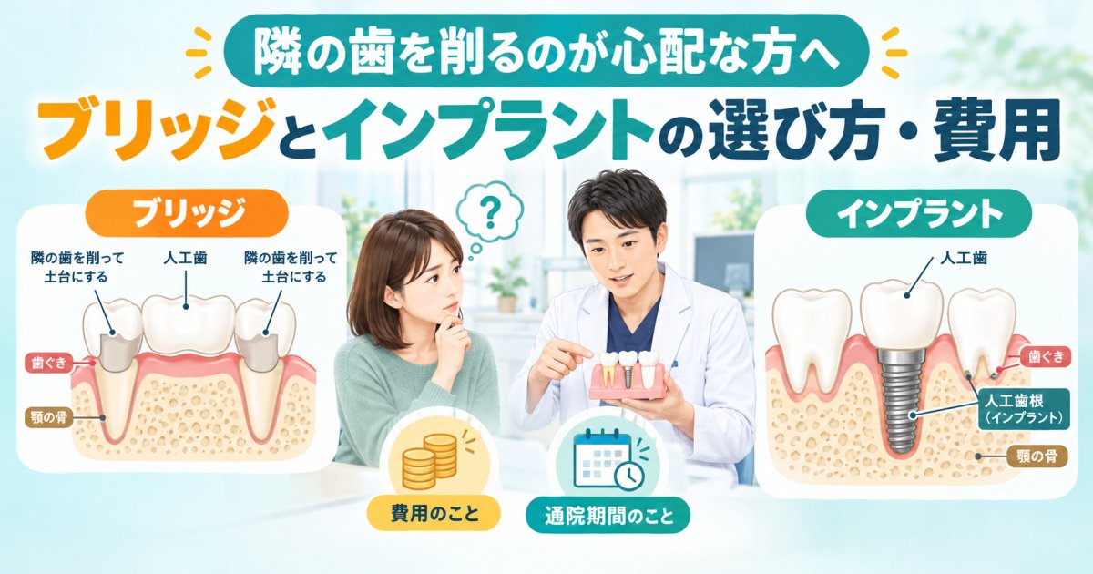 隣の歯を削るのが心配な方へ｜ブリッジとインプラントの選び方と費用
